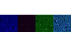 Immunohistochemistry (IHC) image for anti-Cannabinoid Receptor 1 (CNR1) antibody (ABIN7456307) (CNR1 Antikörper)