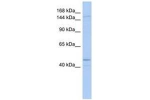Image no. 1 for anti-Superkiller Viralicidic Activity 2-Like (SKIV2L) (AA 863-912) antibody (ABIN6742676) (SKIV2L Antikörper  (AA 863-912))