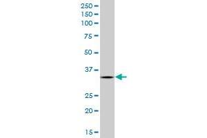 Western Blotting (WB) image for anti-AIMP1 / EMAP II (AA 1-313) antibody (ABIN961494) (AIMP1 / EMAP II (AA 1-313) Antikörper)