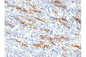 Formalin-fixed, paraffin-embedded human Tonsil stained with CD34 Monoclonal Antibody (QBEnd/10 + HPCA1/763) (CD34 Antikörper)