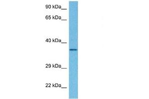 Host:  Rabbit  Target Name:  DHRS7B  Sample Tissue:  Human HepG2 Whole Cell  Antibody Dilution:  1ug/ml (DHRS7B Antikörper  (Middle Region))