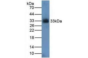 Detection of CDK4 in Rat Kidney Tissue using Polyclonal Antibody to Cyclin Dependent Kinase 4 (CDK4) (CDK4 Antikörper  (AA 6-295))