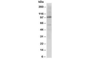 Western blot testing of Cullin 4B antibody and rat lung tissue lysate (Cullin 4B Antikörper  (C-Term))
