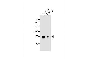 Western Blotting (WB) image for anti-Periostin (POSTN) (AA 687-716), (C-Term) antibody (ABIN655902)