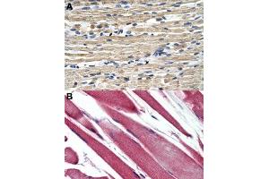 Immunohistochemical staining (Formalin-fixed paraffin-embedded sections) of human skeletal muscle (A, B) with GSTM2 polyclonal antibody . (GSTM2 Antikörper  (N-Term))