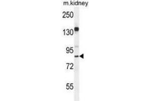 Western blot analysis in mouse kidney tissue lysates (35ug/lane) using MYSM1 Antibody (N-term). (MYSM1 Antikörper  (N-Term))
