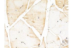 ABIN7094381 and ABIN7098428 at 1/100 staining Mouse muscle tissue by IHC-P. (MYOZ2 Antikörper  (Internal Region))