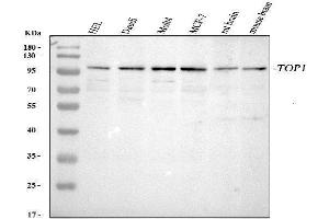 Western blot analysis of Topoisomerase I using anti-Topoisomerase I antibody (ABIN5692844). (Topoisomerase I Antikörper  (AA 526-765))