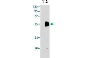 Western blot analysis of PRMT7 (arrow) using PRMT7 polyclonal antibody . (PRMT7 Antikörper  (C-Term))