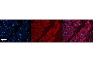 Rabbit Anti-TFB1M Antibody    Formalin Fixed Paraffin Embedded Tissue: Human Adult heart  Observed Staining: Cytoplasmic Primary Antibody Concentration: 1:600 Secondary Antibody: Donkey anti-Rabbit-Cy2/3 Secondary Antibody Concentration: 1:200 Magnification: 20X Exposure Time: 0.