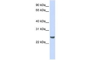 WB Suggested Anti-NKIRAS1 Antibody Titration: 0. (NKIRAS1 Antikörper  (N-Term))