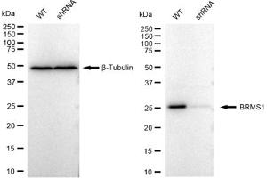 Western blotting analysis using BRMS1 antibody (ABIN7797793). (Rekombinanter BRMS1 Antikörper)