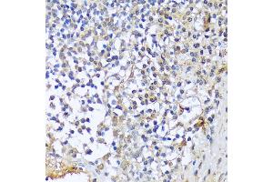 Immunohistochemistry of paraffin-embedded human tonsil using CF antibody (3087) at dilution of 1:100 (40x lens). (A1CF Antikörper  (AA 50-120))