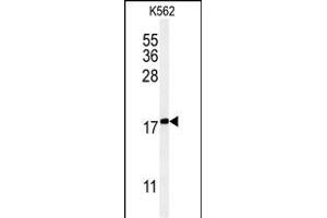 Western blot analysis of KRT1 Antibody (Center) (ABIN651241 and ABIN2840150) in K562 cell line lysates (35 μg/lane). (KRTAP1-1 Antikörper  (AA 88-117))