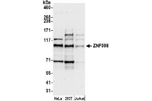 Western Blotting (WB) image for anti-Zinc Finger Protein 598 (ZNF598) (AA 375-425) antibody (ABIN7453019)