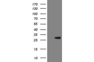 Image no. 1 for anti-RNA Binding Protein with Multiple Splicing (RBPMS) antibody (ABIN1500643) (RBPMS Antikörper)