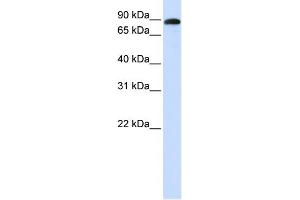 WB Suggested Anti-ADAM19 Antibody Titration:  0. (ADAM19 Antikörper  (N-Term))