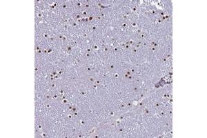 Immunohistochemical staining of human lateral ventricle with LCE6A polyclonal antibody  shows strong nuclear positivity in glial cells. (LCE6A Antikörper)