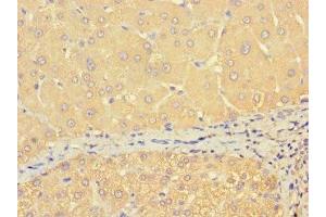 Immunohistochemistry of paraffin-embedded human liver tissue using ABIN7172158 at dilution of 1:100 (THRSP Antikörper  (AA 41-144))