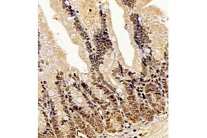 Immunohistochemistry (Paraffin-embedded Sections) (IHC (p)) image for anti-Apoptosis Inhibitor 5 (API5) antibody (ABIN7073094)