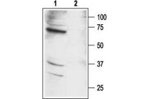 Western blot analysis of mouse kidney lysates:1.