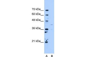 WB Suggested Anti-OAT Antibody Titration:  5. (OAT Antikörper  (C-Term))