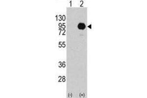 Western Blotting (WB) image for anti-Small Nuclear Ribonucleoprotein Polypeptide E (SNRPE) antibody (ABIN3003509)