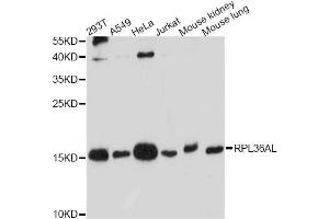 Western blot analysis of extracts of various cell lines, using RPL36AL antibody. (RPL36AL Antikörper)