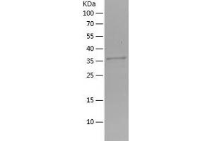 CTHRC1 Protein (AA 31-136) (His-IF2DI Tag)