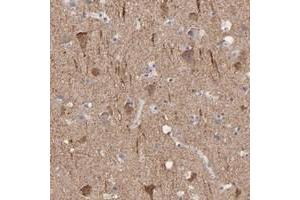 Immunohistochemical staining of human cerebral cortex with CNTN3 polyclonal antibody  shows strong cytoplasmic positivity in neuronal cells at 1:50-1:200 dilution. (CNTN3 Antikörper)
