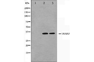 Western blot analysis on COS7 and HuvEc cell lysate using TRADD Antibody. (TRADD Antikörper)