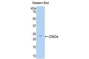 Western Blotting (WB) image for anti-Zyxin (ZYX) (AA 384-572) antibody (ABIN1175612) (ZYX Antikörper  (AA 384-572))
