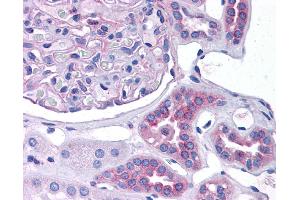 CCL2 antibody was used for immunohistochemistry at a concentration of 4-8 ug/ml. (CCL2 Antikörper  (Middle Region))