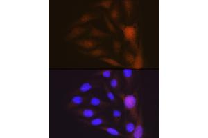 Immunofluorescence analysis of U-2 OS cells using Musashi-1 (MSI1) Rabbit mAb (ABIN7268700) at dilution of 1:100 (40x lens). (MSI1 Antikörper)