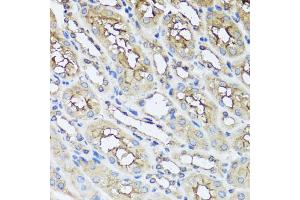 Immunohistochemistry of paraffin-embedded mouse kidney using AIP antibody. (AIP Antikörper)
