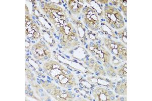 Immunohistochemistry of paraffin-embedded mouse kidney using AIP antibody. (AIP Antikörper)