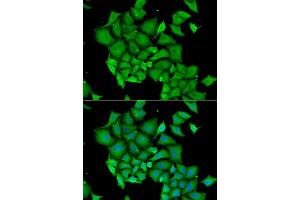 Immunofluorescence analysis of HeLa cell using DFFA antibody. (DFFA Antikörper)