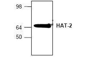 Image no. 1 for anti-MYST Histone Acetyltransferase 2 (MYST2) (N-Term) antibody (ABIN155154) (MYST2 Antikörper  (N-Term))