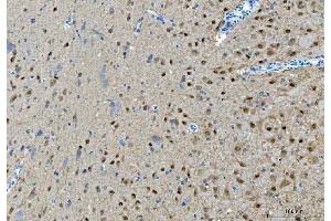 IHC analysis of PRMT5 using anti-PRMT5 antibody (ABIN7600176).