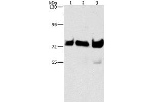 Western Blot analysis of Hela, Raji and 293T cell using BRAF Polyclonal Antibody at dilution of 1:500 (BRAF Antikörper)