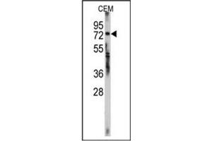 Image no. 1 for anti-Zinc Finger Protein 219 (ZNF219) (AA 660-690), (C-Term) antibody (ABIN357353) (ZNF219 Antikörper  (C-Term))
