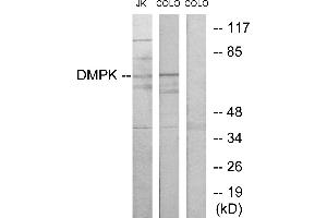 Western blot analysis of extracts from Jurkat cells and COLO205 cells, using DMPK antibody. (DMPK Antikörper)
