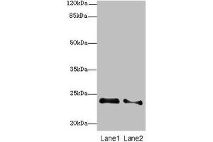 Western blot All lanes: RRAS2 antibody at 2. (RRAS2 Antikörper  (AA 1-204))