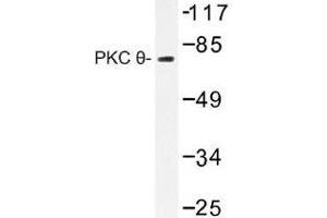 Image no. 1 for anti-Protein Kinase C, theta (PRKCQ) antibody (ABIN317883) (PKC theta Antikörper)