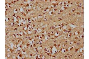 IHC image of ABIN7167791 diluted at 1:300 and staining in paraffin-embedded human brain tissue performed on a Leica BondTM system. (p130 Antikörper  (AA 417-616))