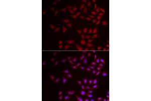 Immunofluorescence (IF) image for anti-Cold Inducible RNA Binding Protein (CIRBP) (AA 1-172) antibody (ABIN6138628)