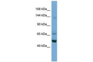 Image no. 1 for anti-Tripartite Motif Containing 66 (TRIM66) (AA 359-408) antibody (ABIN6745662) (TRIM66 Antikörper  (AA 359-408))