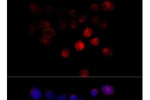 Immunofluorescence analysis of 293T cells using TOM1 Polyclonal Antibody at dilution of 1:100 (40x lens). (TOM1 Antikörper)
