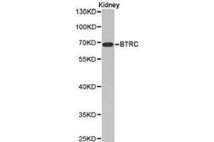 Western Blotting (WB) image for anti-beta-Transducin Repeat Containing (BTRC) antibody (ABIN1871369) (BTRC Antikörper)