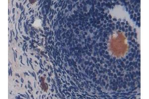 DAB staining on IHC-P; Samples: Rat Ovary Tissue (CD8B Antikörper  (AA 21-208))
